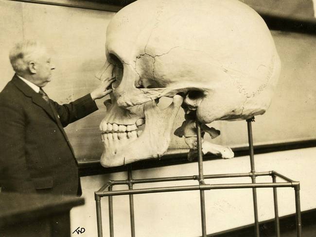 Fake-Skull-made-in-1890s.Haris-p-Mosher-Harvard-MS-1929.jpg