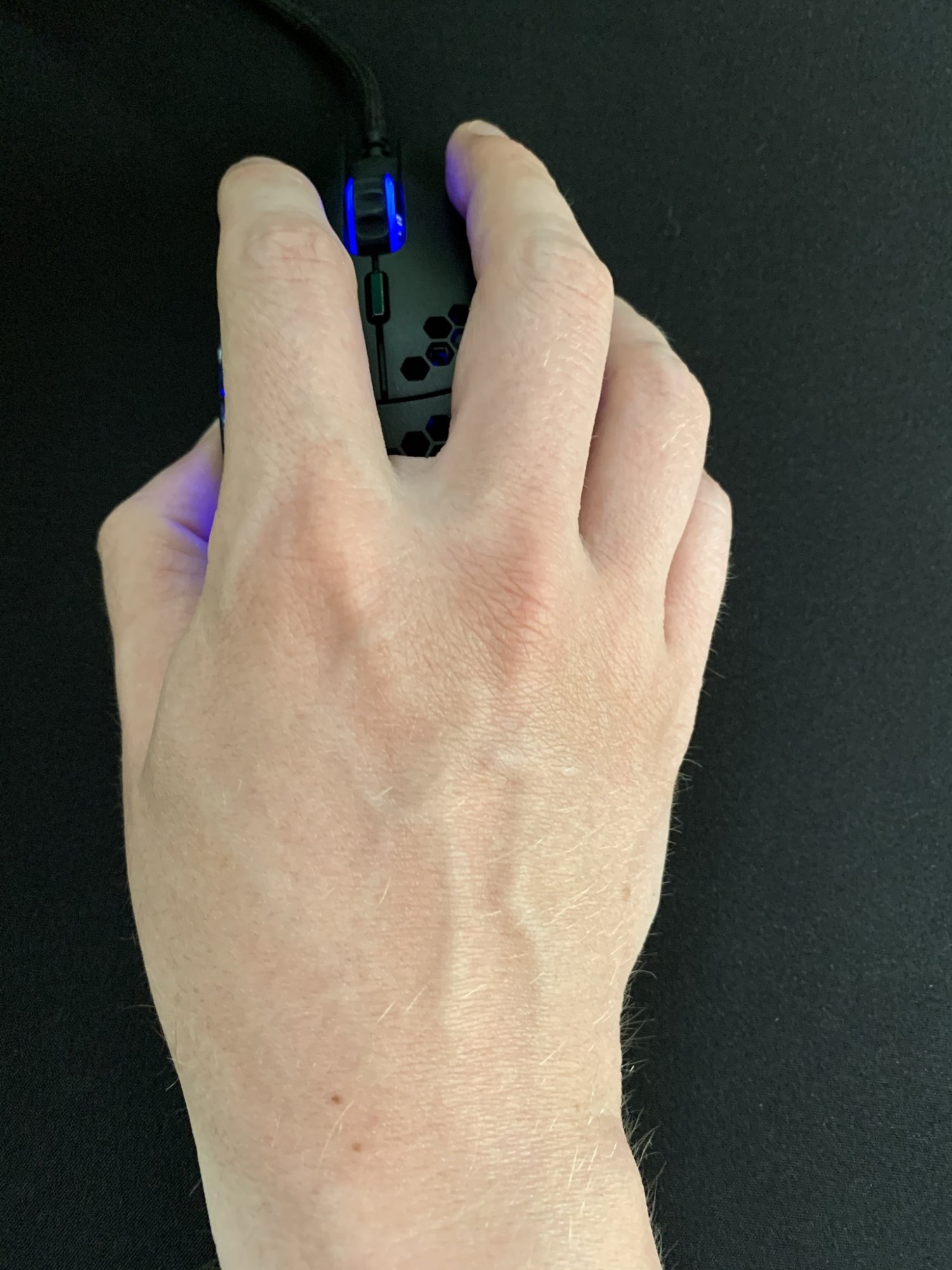 mouse finger pain reddit